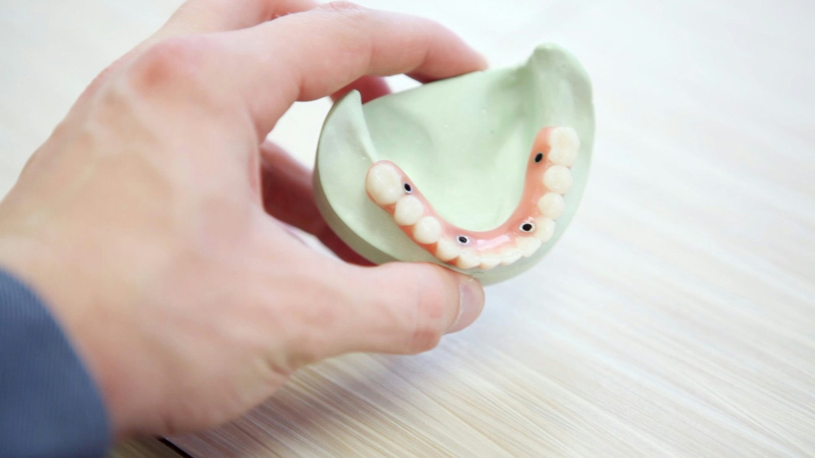 All-on-4 Dental Implants